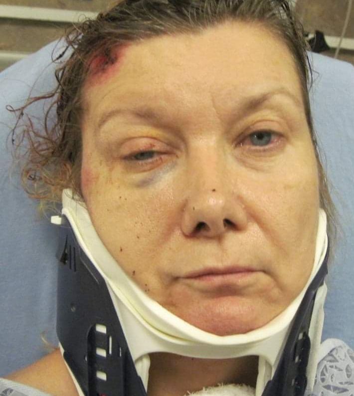 Marti Winlker - beaten up by the Phoenix Police Officer Jason Gillespie /  Jason Gillispie at Circle K on 7th Avenue and Missouri 