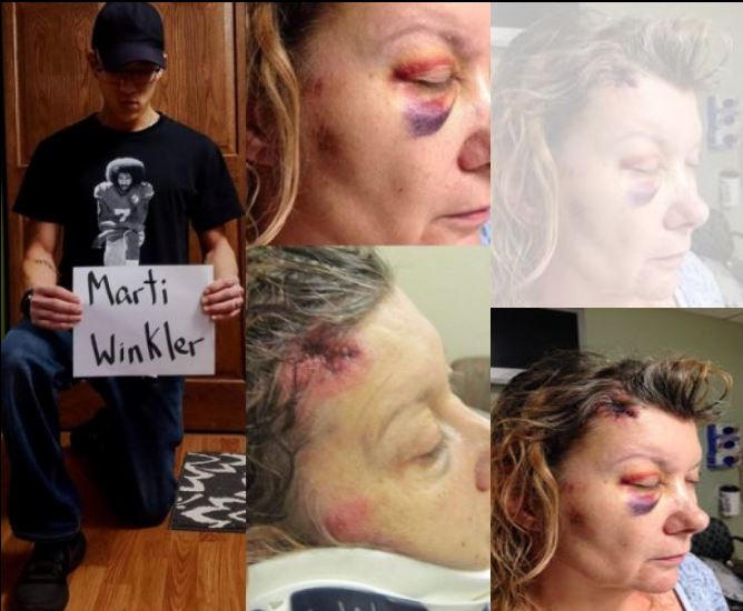 Marti Winlker - beaten up by the Phoenix Police Officer Jason Gillespie /  Jason Gillispie at Circle K on 7th Avenue and Missouri 