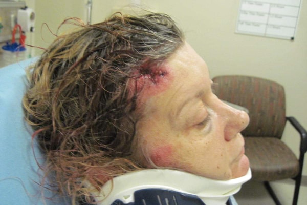 Marti Winlker - beaten up by the Phoenix Police Officer Jason Gillespie /  Jason Gillispie at Circle K on 7th Avenue and Missouri 