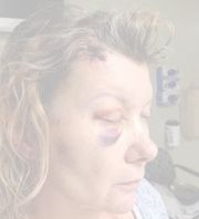 Marti Winlker - beaten up by the Phoenix Police Officer Jason Gillespie at Circle K on 7th Avenue and Missouri 
